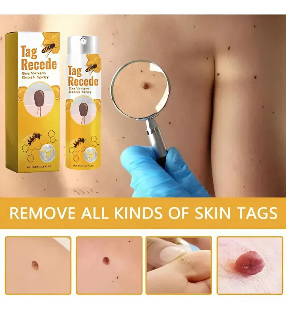 TAGXEL PRO™ — El Eliminador de Imperfecciones que REVOLUCIONA tu piel + Envío Gratis
